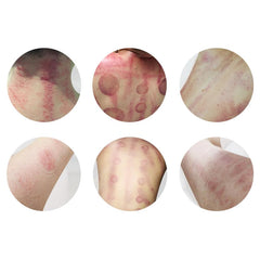 5-in-1 80K Slimming Cavitation Machine Ultrasonic Cavitation, Radio Skin Frequency for Effective Weight Loss & Skin Tightening