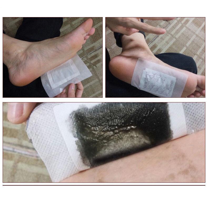 Natural Detox Foot Pads - Easy-to-Use Adhesive Patches